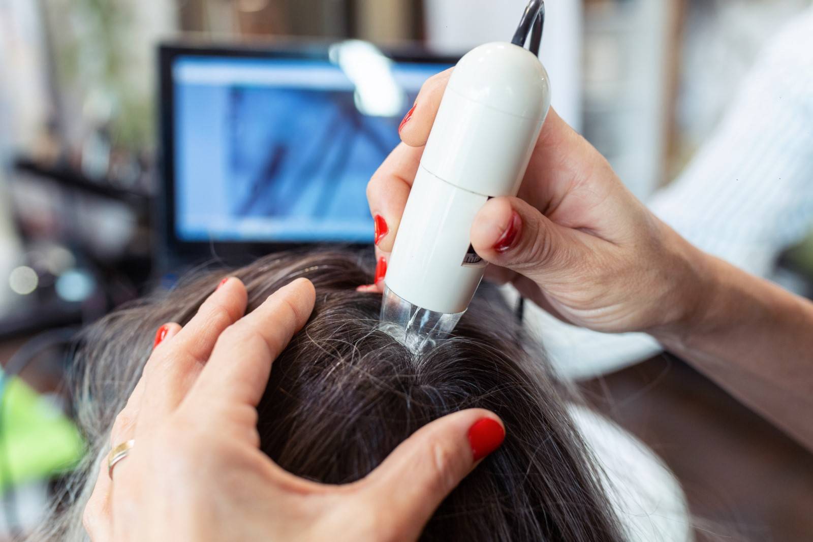 Diagnostic et bilan capillaire à Sorgues (84)