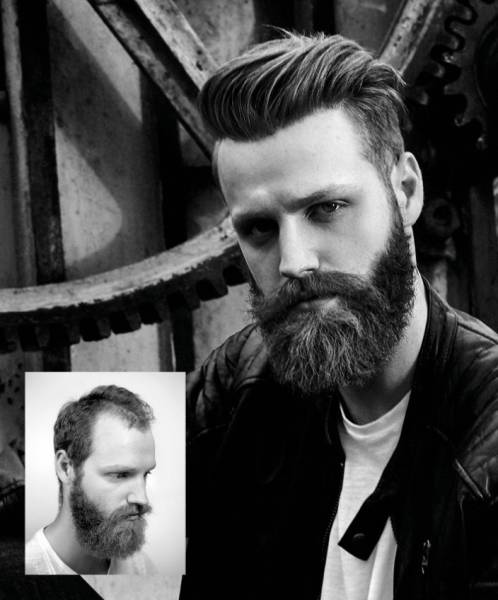 Se faire poser un complément capillaire pour homme près de Nîmes