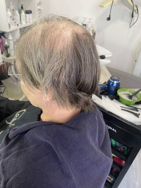 Institut à Sorgues expert en solutions contre la perte de cheveux