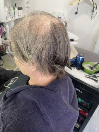 Notre zone d'activité pour ce service Séance de cryothérapie visage pour supprimer un double menton
